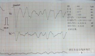 myheartbeat中文意思是什么 myheartbeat